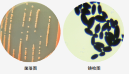 菌落总数检测报告，菌落总数检测方法